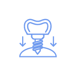 En caso de la pérdida de uno o más dientes, se coloca un implante de titanio para recomponer la funcionalidad y
la estética de tu sonrisa.